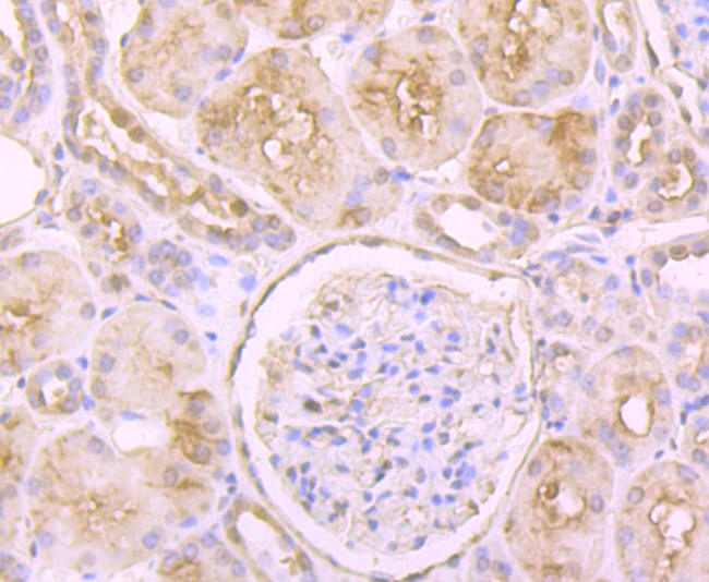 Immunohistochemical analysis of paraffin-embedded human kidney tissue using anti-Glutathione Synthetase antibody. The section was pre-treated using heat mediated antigen retrieval with Tris-EDTA buffer (pH 9.0) for 20 minutes.The tissues were blocked in 1% BSA for 30 minutes at room temperature, washed with ddH2O and PBS, and then probed with the primary antibody (ET7107-62, 1/50) for 30 minutes at room temperature. The detection was performed using an HRP conjugated compact polymer system. DAB was used as the chromogen. Tissues were counterstained with hematoxylin and mounted with DPX.