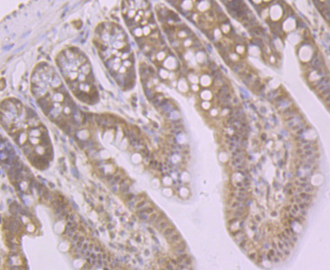 Immunohistochemical analysis of paraffin-embedded mouse colon tissue using anti-Glutathione Synthetase antibody. The section was pre-treated using heat mediated antigen retrieval with Tris-EDTA buffer (pH 9.0) for 20 minutes.The tissues were blocked in 1% BSA for 30 minutes at room temperature, washed with ddH2O and PBS, and then probed with the primary antibody (ET7107-62, 1/50) for 30 minutes at room temperature. The detection was performed using an HRP conjugated compact polymer system. DAB was used as the chromogen. Tissues were counterstained with hematoxylin and mounted with DPX.