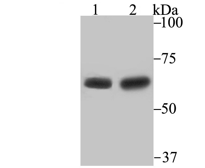 Western blot analysis of STIP1 on Mouse testis and Rat testis lysates using anti-STIP1 antibody at 1/500 dilution.