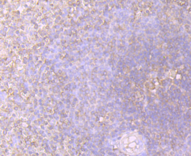 Immunohistochemical analysis of paraffin-embedded human spleen tissue using anti-STIP1 antibody. Counter stained with hematoxylin.