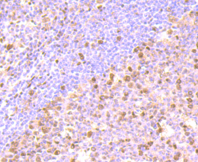 Immunohistochemical analysis of paraffin-embedded human tonsil tissue using anti-FKBP51 antibody. The section was pre-treated using heat mediated antigen retrieval with Tris-EDTA buffer (pH 8.0-8.4) for 20 minutes.The tissues were blocked in 5% BSA for 30 minutes at room temperature, washed with ddH2O and PBS, and then probed with the primary antibody (ET7107-64, 1/50) for 30 minutes at room temperature. The detection was performed using an HRP conjugated compact polymer system. DAB was used as the chromogen. Tissues were counterstained with hematoxylin and mounted with DPX.