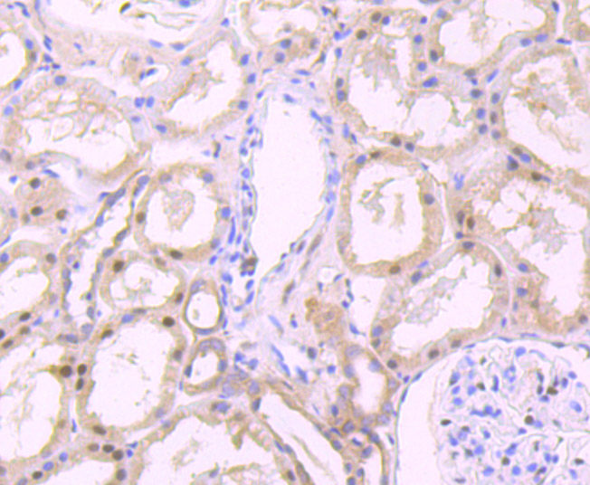 Immunohistochemical analysis of paraffin-embedded human kidney tissue using anti-FKBP51 antibody. The section was pre-treated using heat mediated antigen retrieval with Tris-EDTA buffer (pH 8.0-8.4) for 20 minutes.The tissues were blocked in 5% BSA for 30 minutes at room temperature, washed with ddH2O and PBS, and then probed with the primary antibody (ET7107-64, 1/50) for 30 minutes at room temperature. The detection was performed using an HRP conjugated compact polymer system. DAB was used as the chromogen. Tissues were counterstained with hematoxylin and mounted with DPX.