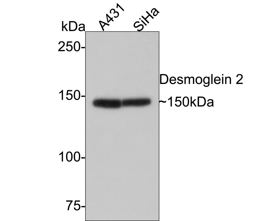Western blot analysis of Desmoglein 2 on different lysates with Rabbit anti-Desmoglein 2 antibody (ET7107-65) at 1/500 dilution.<br />
<br />
Lane 1: A431 cell lysate<br />
Lane 2: SiHa cell lysate<br />
<br />
Lysates/proteins at 10 µg/Lane.<br />
<br />
Predicted band size: 122 kDa<br />
Observed band size: 150 kDa<br />
<br />
Exposure time: 2 minutes;<br />
<br />
6% SDS-PAGE gel.<br />
<br />
Proteins were transferred to a PVDF membrane and blocked with 5% NFDM/TBST for 1 hour at room temperature. The primary antibody (ET7107-65) at 1/500 dilution was used in 5% NFDM/TBST at room temperature for 2 hours. Goat Anti-Rabbit IgG - HRP Secondary Antibody (HA1001) at 1:300,000 dilution was used for 1 hour at room temperature.