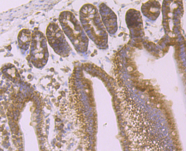 Immunohistochemical analysis of paraffin-embedded mouse small intestine tissue using anti-Desmoglein 2 antibody. Counter stained with hematoxylin.