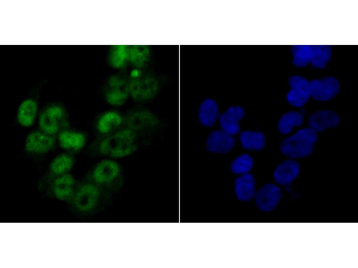 ICC staining MCM3 in 293T cells (green). The nuclear counter stain is DAPI (blue). Cells were fixed in paraformaldehyde, permeabilised with 0.25% Triton X100/PBS.