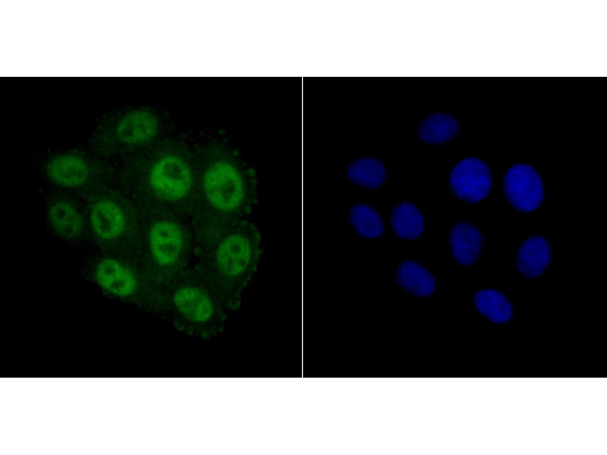 ICC staining MCM3 in HepG2 cells (green). The nuclear counter stain is DAPI (blue). Cells were fixed in paraformaldehyde, permeabilised with 0.25% Triton X100/PBS.