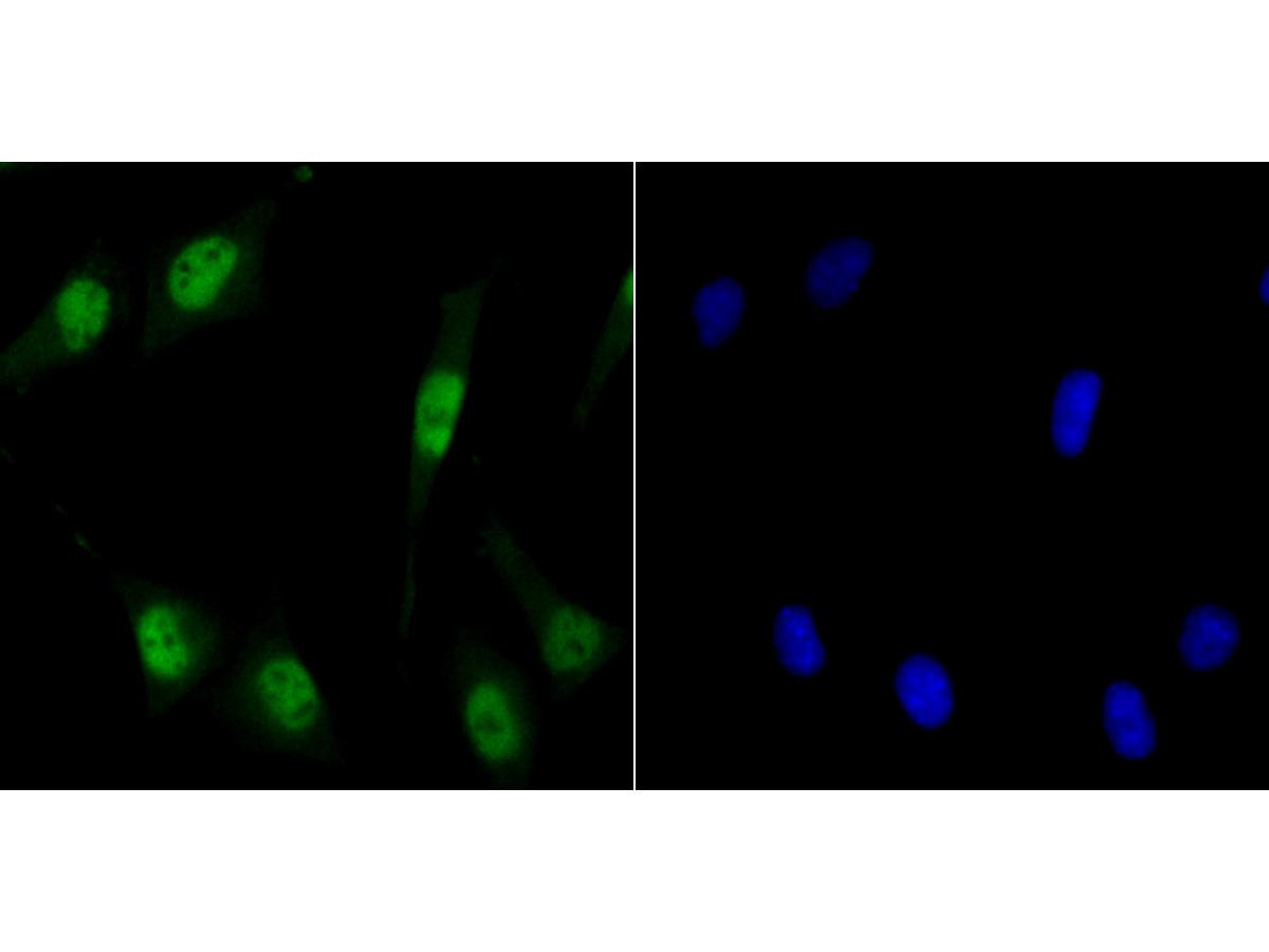 ICC staining MCM3 in SH-SY-5Y cells (green). The nuclear counter stain is DAPI (blue). Cells were fixed in paraformaldehyde, permeabilised with 0.25% Triton X100/PBS.