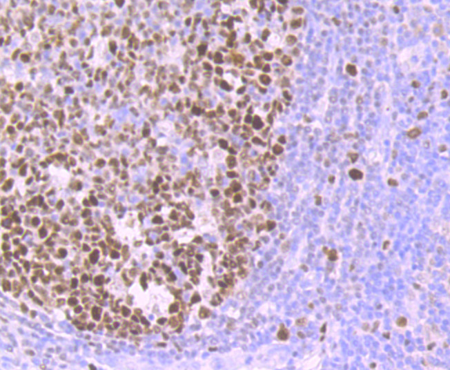 Immunohistochemical analysis of paraffin-embedded human tonsil tissue using anti-MCM3 antibody. Counter stained with hematoxylin.