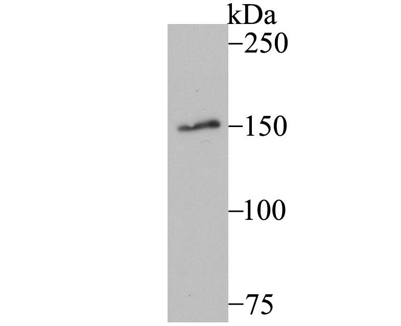 Western blot analysis of MYBBP1A on A549 cell lysate using anti-MYBBP1A antibody at 1/500 dilution.