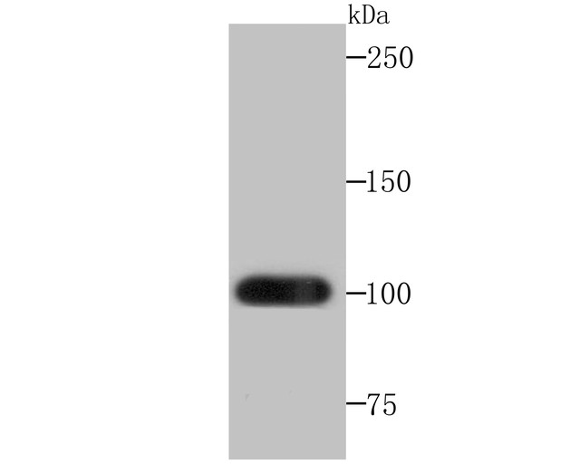 Western blot analysis of Frizzled 8 on mouse lung tissue lysates. Proteins were transferred to a PVDF membrane and blocked with 5% BSA in PBS for 1 hour at room temperature. The primary antibody (ET7107-68, 1/500) was used in 5% BSA at room temperature for 2 hours. Goat Anti-Rabbit IgG - HRP Secondary Antibody (HA1001) at 1:200,000 dilution was used for 1 hour at room temperature.