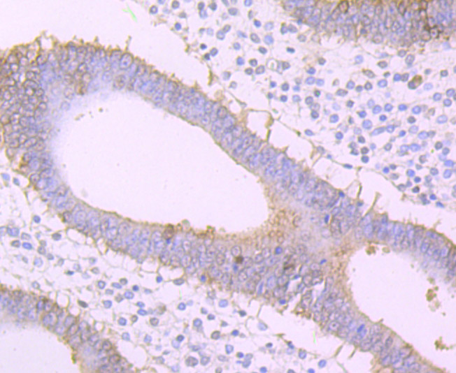 Immunohistochemical analysis of paraffin-embedded human uterus tissue using anti-Frizzled 8 antibody. The section was pre-treated using heat mediated antigen retrieval with Tris-EDTA buffer (pH 8.0-8.4) for 20 minutes.The tissues were blocked in 5% BSA for 30 minutes at room temperature, washed with ddH2O and PBS, and then probed with the primary antibody (ET7107-68, 1/50) for 30 minutes at room temperature. The detection was performed using an HRP conjugated compact polymer system. DAB was used as the chromogen. Tissues were counterstained with hematoxylin and mounted with DPX.