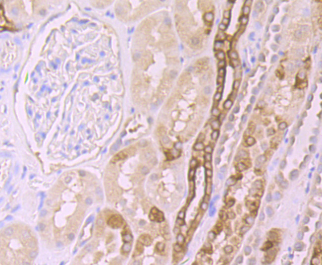 Immunohistochemical analysis of paraffin-embedded human kidney tissue using anti-Frizzled 8 antibody. The section was pre-treated using heat mediated antigen retrieval with Tris-EDTA buffer (pH 8.0-8.4) for 20 minutes.The tissues were blocked in 5% BSA for 30 minutes at room temperature, washed with ddH2O and PBS, and then probed with the primary antibody (ET7107-68, 1/50) for 30 minutes at room temperature. The detection was performed using an HRP conjugated compact polymer system. DAB was used as the chromogen. Tissues were counterstained with hematoxylin and mounted with DPX.