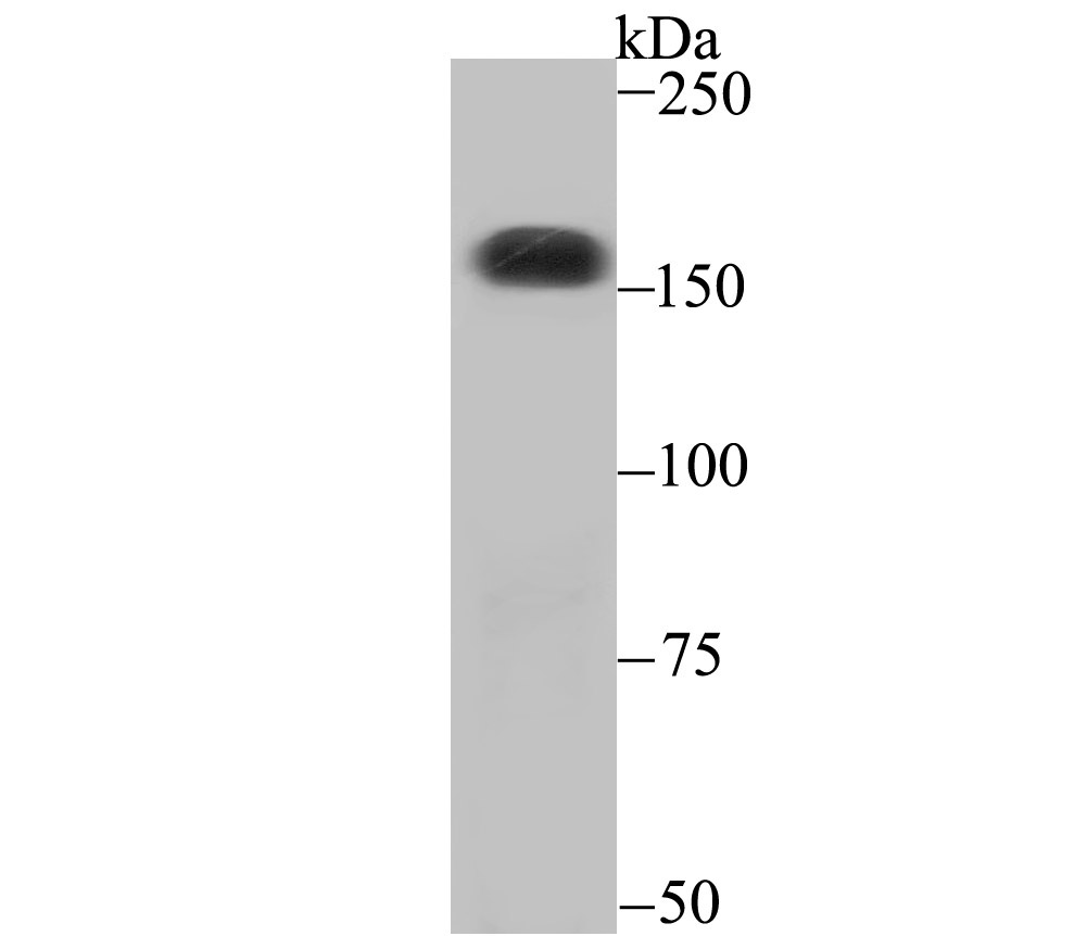 Western blot analysis of CPS1 on SiHa cell lysates. Proteins were transferred to a PVDF membrane and blocked with 5% BSA in PBS for 1 hour at room temperature. The primary antibody (ET7107-69, 1/500) was used in 5% BSA at room temperature for 2 hours. Goat Anti-Rabbit IgG - HRP Secondary Antibody (HA1001) at 1:200,000 dilution was used for 1 hour at room temperature.