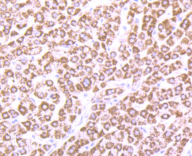 Immunohistochemical analysis of paraffin-embedded human liver tissue using anti-CPS1 antibody. The section was pre-treated using heat mediated antigen retrieval with Tris-EDTA buffer (pH 9.0) for 20 minutes.The tissues were blocked in 1% BSA for 30 minutes at room temperature, washed with ddH2O and PBS, and then probed with the primary antibody (ET7107-69, 1/50) for 30 minutes at room temperature. The detection was performed using an HRP conjugated compact polymer system. DAB was used as the chromogen. Tissues were counterstained with hematoxylin and mounted with DPX.