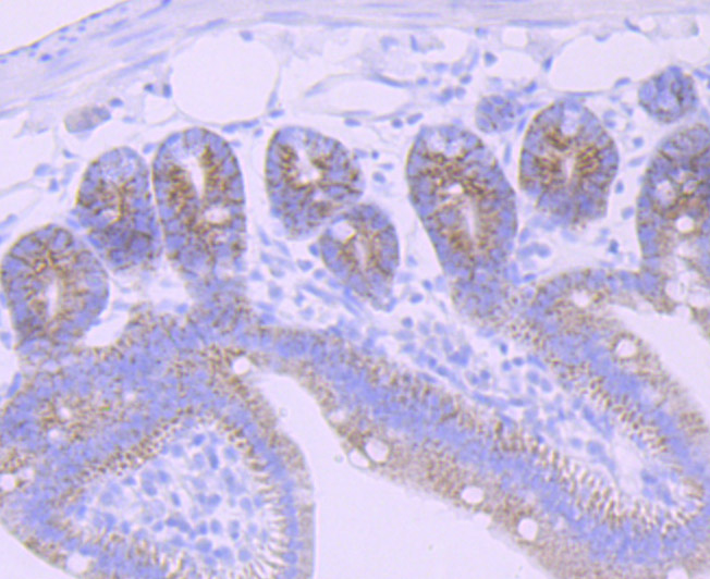Immunohistochemical analysis of paraffin-embedded mouse small intestine tissue using anti-CPS1 antibody. The section was pre-treated using heat mediated antigen retrieval with Tris-EDTA buffer (pH 9.0) for 20 minutes.The tissues were blocked in 1% BSA for 30 minutes at room temperature, washed with ddH2O and PBS, and then probed with the primary antibody (ET7107-69, 1/50) for 30 minutes at room temperature. The detection was performed using an HRP conjugated compact polymer system. DAB was used as the chromogen. Tissues were counterstained with hematoxylin and mounted with DPX.