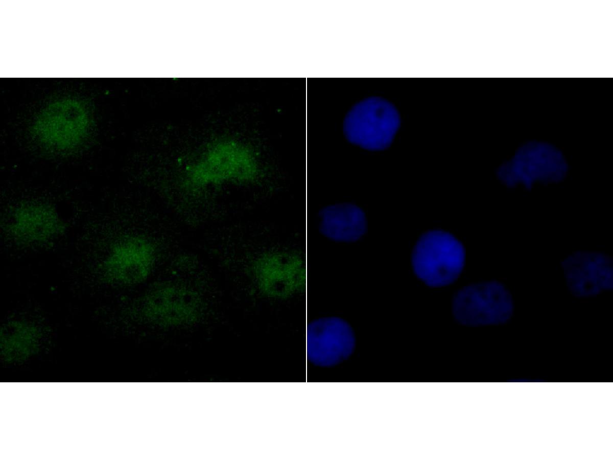 ICC staining of SF2 in A431 cells (green). Formalin fixed cells were permeabilized with 0.1% Triton X-100 in TBS for 10 minutes at room temperature and blocked with 10% negative goat serum for 15 minutes at room temperature. Cells were probed with the primary antibody (ET7107-70, 1/50) for 1 hour at room temperature, washed with PBS. Alexa Fluor®488 conjugate-Goat anti-Rabbit IgG was used as the secondary antibody at 1/1,000 dilution. The nuclear counter stain is DAPI (blue).