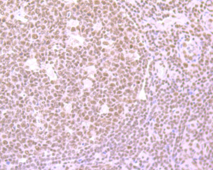 Immunohistochemical analysis of paraffin-embedded human tonsil tissue using anti-SF2 antibody. The section was pre-treated using heat mediated antigen retrieval with Tris-EDTA buffer (pH 9.0) for 20 minutes.The tissues were blocked in 1% BSA for 30 minutes at room temperature, washed with ddH2O and PBS, and then probed with the primary antibody (ET7107-70, 1/50) for 30 minutes at room temperature. The detection was performed using an HRP conjugated compact polymer system. DAB was used as the chromogen. Tissues were counterstained with hematoxylin and mounted with DPX.