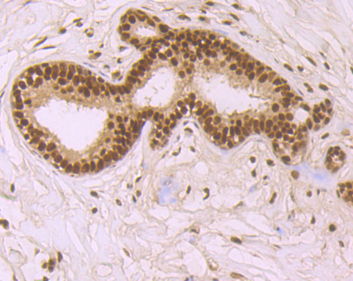 Immunohistochemical analysis of paraffin-embedded human breast tissue using anti-SF2 antibody. The section was pre-treated using heat mediated antigen retrieval with Tris-EDTA buffer (pH 9.0) for 20 minutes.The tissues were blocked in 1% BSA for 30 minutes at room temperature, washed with ddH2O and PBS, and then probed with the primary antibody (ET7107-70, 1/50) for 30 minutes at room temperature. The detection was performed using an HRP conjugated compact polymer system. DAB was used as the chromogen. Tissues were counterstained with hematoxylin and mounted with DPX.