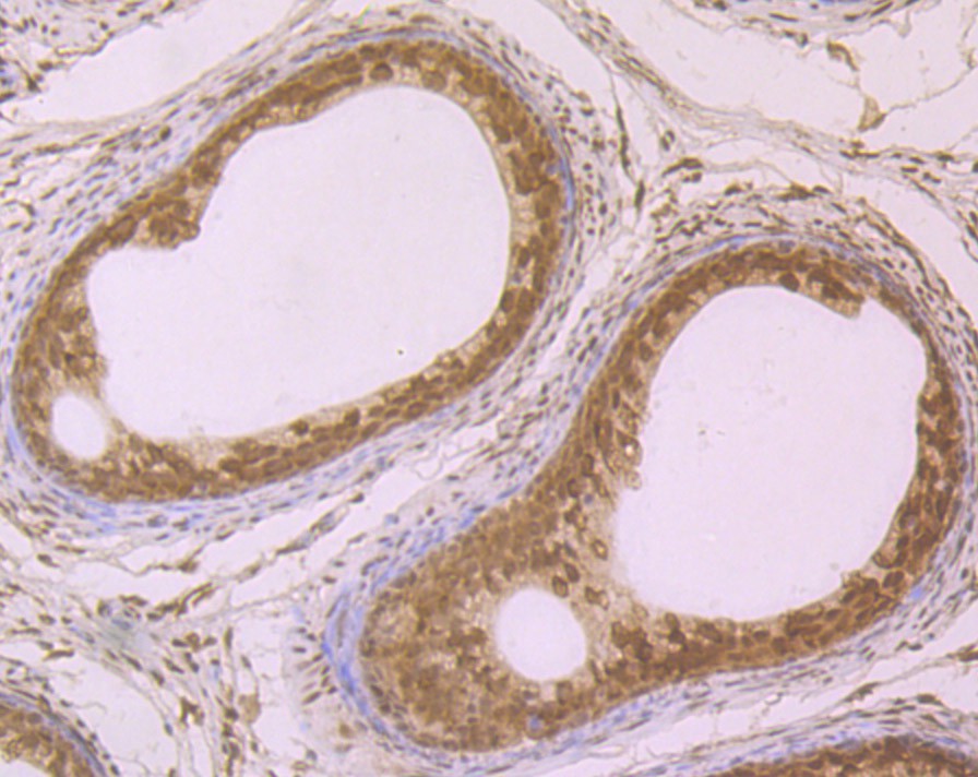 Immunohistochemical analysis of paraffin-embedded rat epididymis tissue using anti-SF2 antibody. The section was pre-treated using heat mediated antigen retrieval with Tris-EDTA buffer (pH 9.0) for 20 minutes.The tissues were blocked in 1% BSA for 30 minutes at room temperature, washed with ddH2O and PBS, and then probed with the primary antibody (ET7107-70, 1/50) for 30 minutes at room temperature. The detection was performed using an HRP conjugated compact polymer system. DAB was used as the chromogen. Tissues were counterstained with hematoxylin and mounted with DPX.