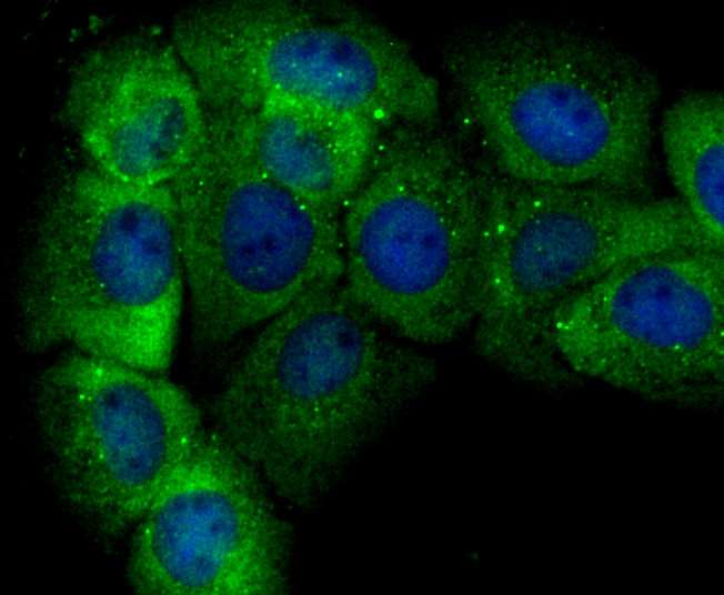 ICC staining of GST3 in A431 cells (green). Formalin fixed cells were permeabilized with 0.1% Triton X-100 in TBS for 10 minutes at room temperature and blocked with 1% Blocker BSA for 15 minutes at room temperature. Cells were probed with the primary antibody (ET7107-71, 1/50) for 1 hour at room temperature, washed with PBS. Alexa Fluor®488 Goat anti-Rabbit IgG was used as the secondary antibody at 1/1,000 dilution. The nuclear counter stain is DAPI (blue).