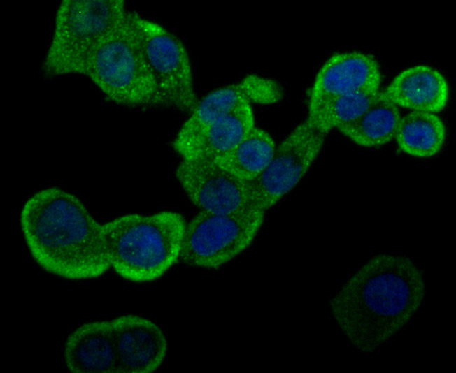 ICC staining of GST3 in LOVO cells (green). Formalin fixed cells were permeabilized with 0.1% Triton X-100 in TBS for 10 minutes at room temperature and blocked with 1% Blocker BSA for 15 minutes at room temperature. Cells were probed with the primary antibody (ET7107-71, 1/50) for 1 hour at room temperature, washed with PBS. Alexa Fluor®488 Goat anti-Rabbit IgG was used as the secondary antibody at 1/1,000 dilution. The nuclear counter stain is DAPI (blue).