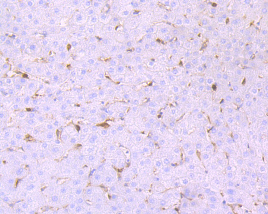 Immunohistochemical analysis of paraffin-embedded human liver tissue using anti-GST3 antibody. The section was pre-treated using heat mediated antigen retrieval with Tris-EDTA buffer (pH 8.0-8.4) for 20 minutes.The tissues were blocked in 5% BSA for 30 minutes at room temperature, washed with ddH2O and PBS, and then probed with the primary antibody (ET7107-71, 1/50) for 30 minutes at room temperature. The detection was performed using an HRP conjugated compact polymer system. DAB was used as the chromogen. Tissues were counterstained with hematoxylin and mounted with DPX.