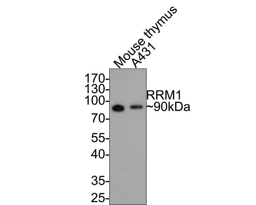 Western blot analysis of RRM1 on different lysates with Rabbit anti-RRM1 antibody (ET7107-72) at 1/500 dilution.<br />
<br />
Lane 1: Mouse thymus tissue lysate (20 µg/Lane)<br />
Lane 2: A431 cell lysate<br />
<br />
Lysates/proteins at 10 µg/Lane.<br />
<br />
Predicted band size: 90 kDa<br />
Observed band size: 90 kDa<br />
<br />
Exposure time: 1 minute;<br />
<br />
10% SDS-PAGE gel.<br />
<br />
Proteins were transferred to a PVDF membrane and blocked with 5% NFDM/TBST for 1 hour at room temperature. The primary antibody (ET7107-72) at 1/500 dilution was used in 5% NFDM/TBST at room temperature for 2 hours. Goat Anti-Rabbit IgG - HRP Secondary Antibody (HA1001) at 1:200,000 dilution was used for 1 hour at room temperature.