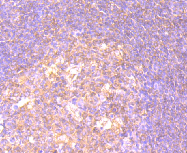 Immunohistochemical analysis of paraffin-embedded human tonsil tissue using anti-CD27 antibody. The section was pre-treated using heat mediated antigen retrieval with Tris-EDTA buffer (pH 8.0-8.4) for 20 minutes.The tissues were blocked in 5% BSA for 30 minutes at room temperature, washed with ddH2O and PBS, and then probed with the primary antibody (ET7107-73, 1/50) for 30 minutes at room temperature. The detection was performed using an HRP conjugated compact polymer system. DAB was used as the chromogen. Tissues were counterstained with hematoxylin and mounted with DPX.