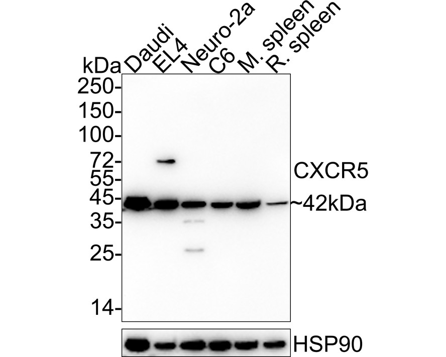Western blot analysis of CXCR5 on different lysates. Proteins were transferred to a PVDF membrane and blocked with 5% BSA in PBS for 1 hour at room temperature. The primary antibody (ET7107-74, 1/500) was used in 5% BSA at room temperature for 2 hours. Goat Anti-Rabbit IgG - HRP Secondary Antibody (HA1001) at 1:5,000 dilution was used for 1 hour at room temperature.<br />
Positive control: <br />
Lane 1: Daudi cell lysate<br />
Lane 2: Raji cell lysate