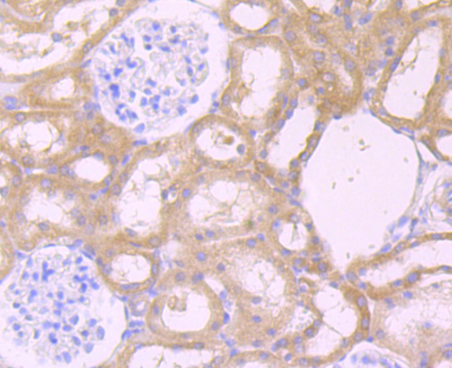 Immunohistochemical analysis of paraffin-embedded mouse heart tissue using anti-CXCR5 antibody. The section was pre-treated using heat mediated antigen retrieval with Tris-EDTA buffer (pH 8.0-8.4) for 20 minutes.The tissues were blocked in 5% BSA for 30 minutes at room temperature, washed with ddH2O and PBS, and then probed with the primary antibody (ET7107-74, 1/50) for 30 minutes at room temperature. The detection was performed using an HRP conjugated compact polymer system. DAB was used as the chromogen. Tissues were counterstained with hematoxylin and mounted with DPX.