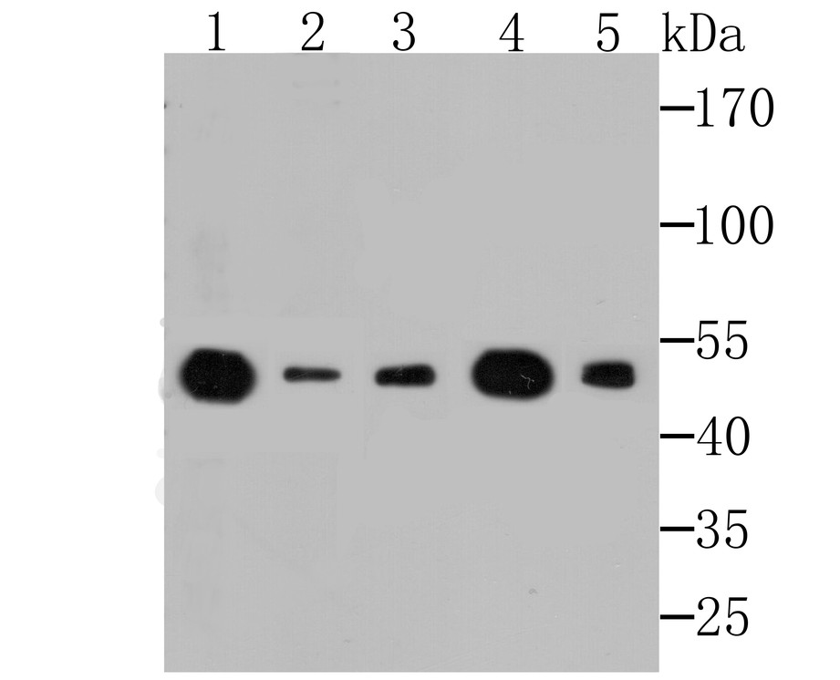 Western blot analysis of eEF1A1 on different lysates. Proteins were transferred to a PVDF membrane and blocked with 5% BSA in PBS for 1 hour at room temperature. The primary antibody (ET7107-75, 1/500) was used in 5% BSA at room temperature for 2 hours. Goat Anti-Rabbit IgG - HRP Secondary Antibody (HA1001) at 1:200,000 dilution was used for 1 hour at room temperature.<br />
Positive control: <br />
Lane 1: Rat brain tissue tissue lysate<br />
Lane 2: Mouse skeletal muscle tissue lysate<br />
Lane 3: Mouse cerebellum tissue lysate<br />
Lane 4: Rat skin tissue lysate<br />
Lane 5: Daudi cell lysate