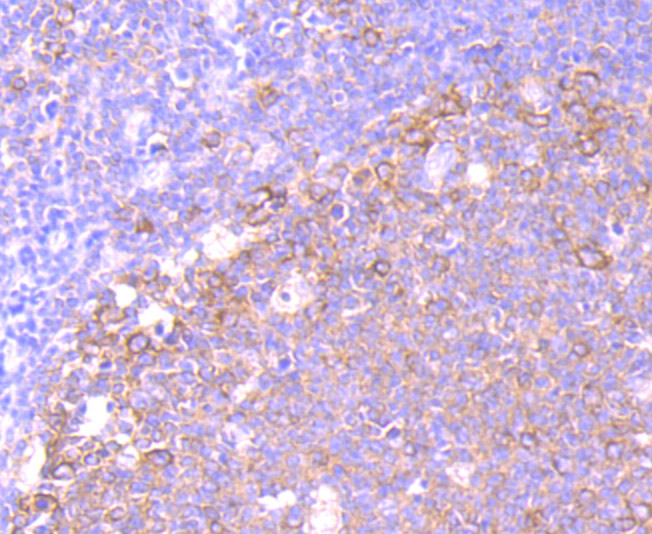 Immunohistochemical analysis of paraffin-embedded human tonsil tissue using anti-eEF1A1 antibody. The section was pre-treated using heat mediated antigen retrieval with Tris-EDTA buffer (pH 8.0-8.4) for 20 minutes.The tissues were blocked in 5% BSA for 30 minutes at room temperature, washed with ddH2O and PBS, and then probed with the primary antibody (ET7107-75, 1/50) for 30 minutes at room temperature. The detection was performed using an HRP conjugated compact polymer system. DAB was used as the chromogen. Tissues were counterstained with hematoxylin and mounted with DPX.