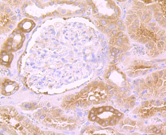 Immunohistochemical analysis of paraffin-embedded human kidney tissue using anti-eEF1A1 antibody. The section was pre-treated using heat mediated antigen retrieval with Tris-EDTA buffer (pH 8.0-8.4) for 20 minutes.The tissues were blocked in 5% BSA for 30 minutes at room temperature, washed with ddH2O and PBS, and then probed with the primary antibody (ET7107-75, 1/50) for 30 minutes at room temperature. The detection was performed using an HRP conjugated compact polymer system. DAB was used as the chromogen. Tissues were counterstained with hematoxylin and mounted with DPX.