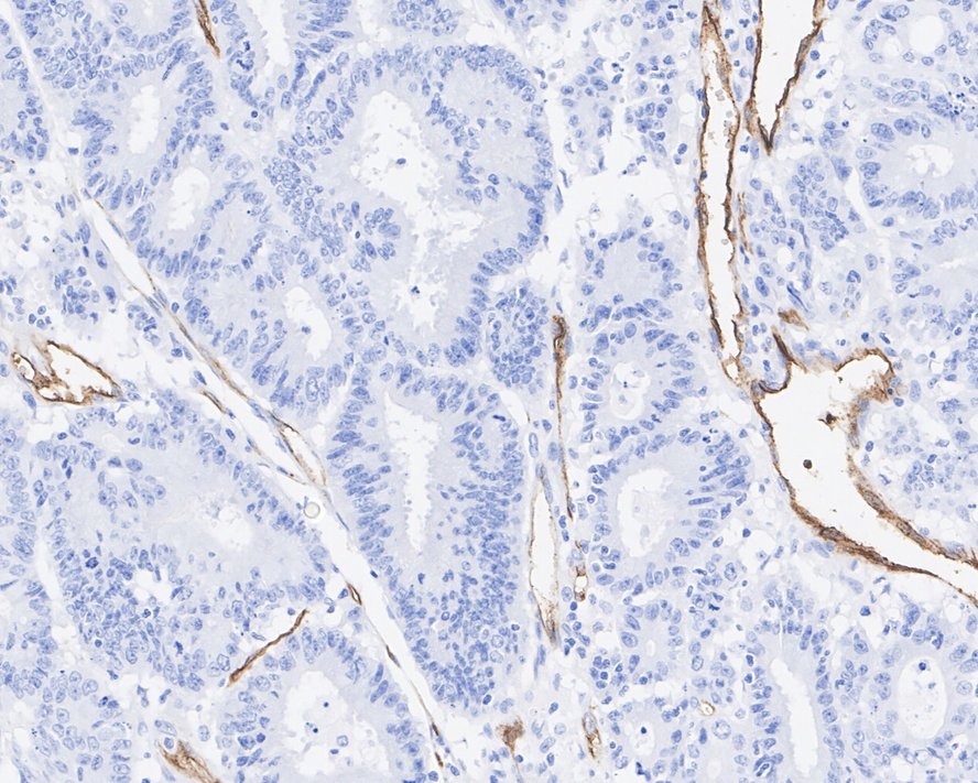 Immunohistochemical analysis of paraffin-embedded rat skeletal muscle tissue using anti-H Cadherin antibody. Counter stained with hematoxylin.