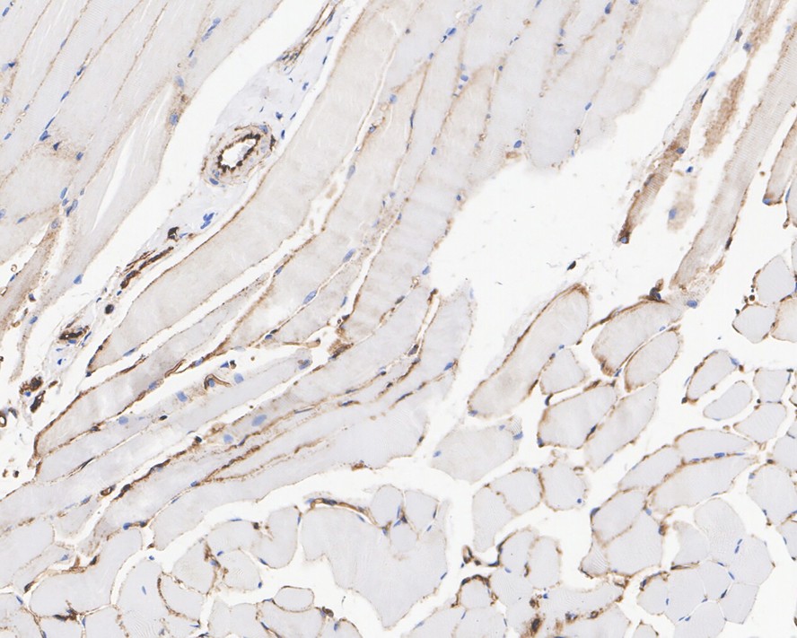 Immunohistochemical analysis of paraffin-embedded human fetal skeletal muscle tissue using anti-H Cadherin antibody. Counter stained with hematoxylin.