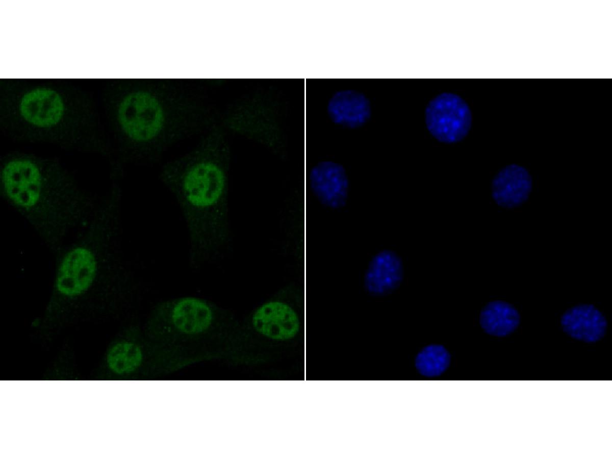 ICC staining MBD3 in NIH/3T3 cells (green). The nuclear counter stain is DAPI (blue). Cells were fixed in paraformaldehyde, permeabilised with 0.25% Triton X100/PBS.