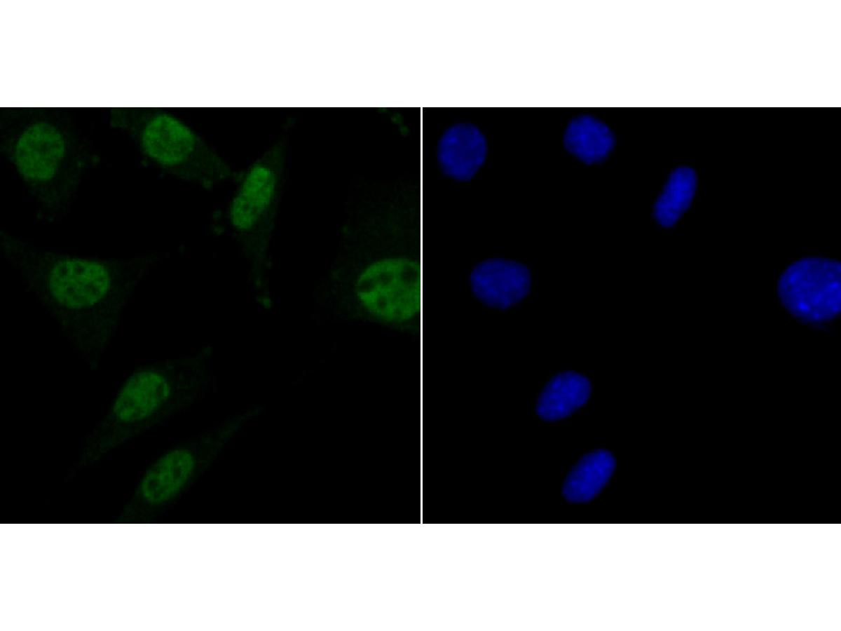 ICC staining MBD3 in SH-SY-5Y cells (green). The nuclear counter stain is DAPI (blue). Cells were fixed in paraformaldehyde, permeabilised with 0.25% Triton X100/PBS.