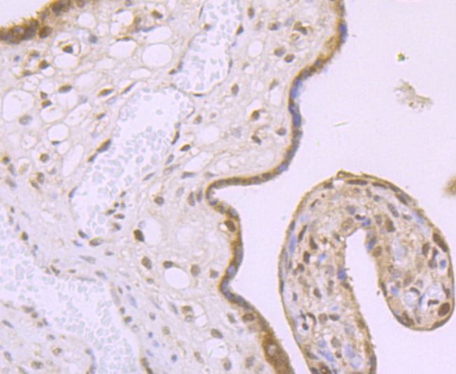 Immunohistochemical analysis of paraffin-embedded human placenta tissue using anti-MBD3 antibody. Counter stained with hematoxylin.