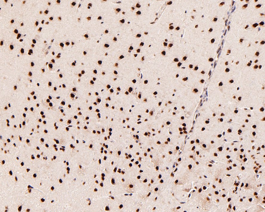 Immunohistochemical analysis of paraffin-embedded mouse brain tissue with Rabbit anti-MBD3 antibody (ET7107-78) at 1/500 dilution.<br />
<br />
The section was pre-treated using heat mediated antigen retrieval with sodium citrate buffer (pH 6.0) for 2 minutes. The tissues were blocked in 1% BSA for 20 minutes at room temperature, washed with ddH2O and PBS, and then probed with the primary antibody (ET7107-78) at 1/500 dilution for 1 hour at room temperature. The detection was performed using an HRP conjugated compact polymer system. DAB was used as the chromogen. Tissues were counterstained with hematoxylin and mounted with DPX.