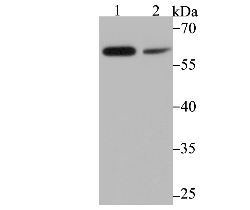 Western blot analysis of PAK2 on mouse thymus tissue  lysate (1) and MCF-7 cell lysate(2) using anti-PAK2 antibody at 1/500 dilution.