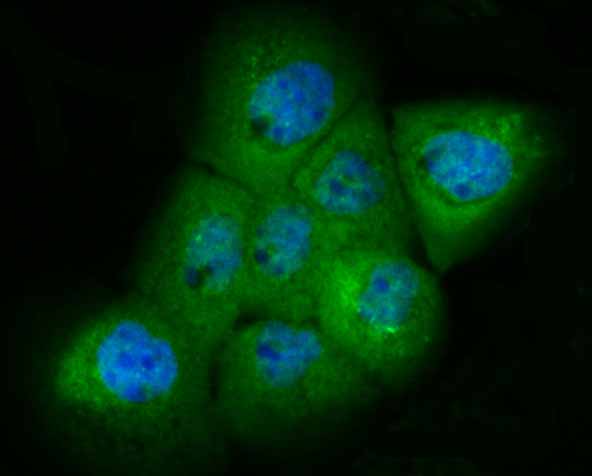 ICC staining PAK2 in A431 cells (green). The nuclear counter stain is DAPI (blue). Cells were fixed in paraformaldehyde, permeabilised with 0.25% Triton X100/PBS.