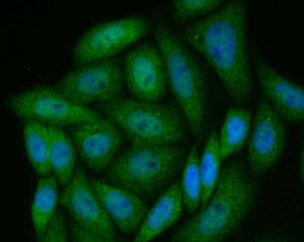 ICC staining PAK2 in SiHa cells (green). The nuclear counter stain is DAPI (blue). Cells were fixed in paraformaldehyde, permeabilised with 0.25% Triton X100/PBS.