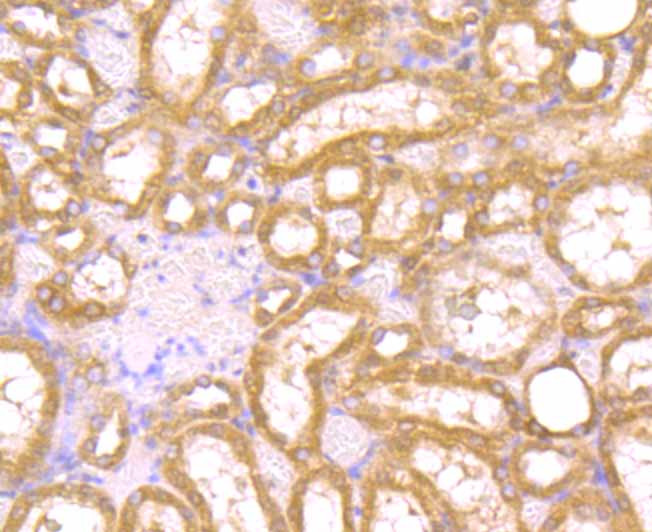 Immunohistochemical analysis of paraffin-embedded rat kidney tissue using anti-PAK2 antibody. Counter stained with hematoxylin.