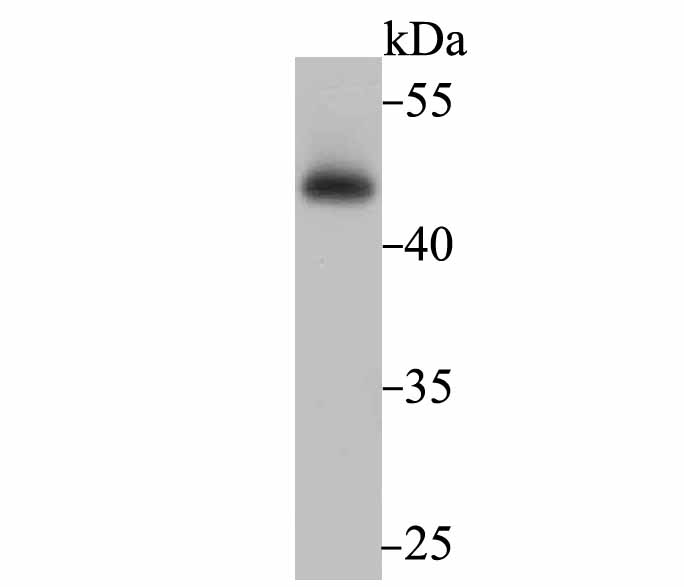 Western blot analysis of Flotillin 1 on PC-3M cell lysate using anti-Flotillin 1 antibody at 1/500 dilution.