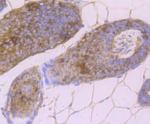 Immunohistochemical analysis of paraffin-embedded mouse skin tissue using anti-DSG1 antibody. Counter stained with hematoxylin.
