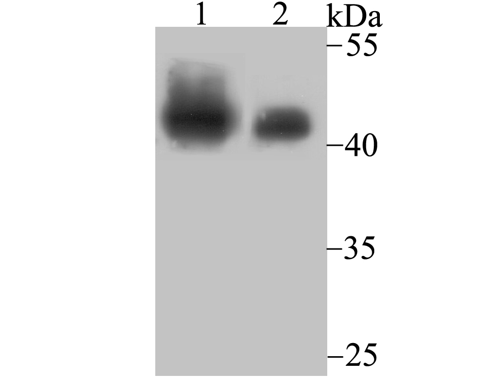 Western blot analysis of SNF5 on Daudi cell lysates and mouse lymph node tissue lysates using anti-SNF5 antibody at 1/500 dilution.