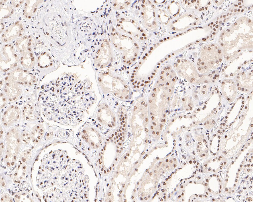 Immunohistochemical analysis of paraffin-embedded human kidney tissue with Rabbit anti-SNF5 antibody (ET7107-84) at 1/200 dilution.<br />
<br />
The section was pre-treated using heat mediated antigen retrieval with sodium citrate buffer (pH 6.0) for 2 minutes. The tissues were blocked in 1% BSA for 20 minutes at room temperature, washed with ddH2O and PBS, and then probed with the primary antibody (ET7107-84) at 1/200 dilution for 1 hour at room temperature. The detection was performed using an HRP conjugated compact polymer system. DAB was used as the chromogen. Tissues were counterstained with hematoxylin and mounted with DPX.