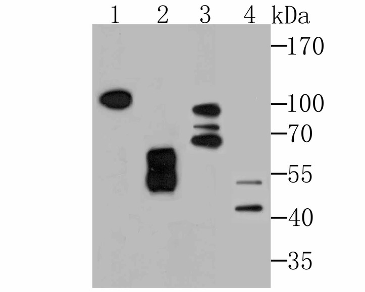 Western blot analysis of KDEL on different lysates. Proteins were transferred to a PVDF membrane and blocked with 5% BSA in PBS for 1 hour at room temperature. The primary antibody (ET7107-86, 1/500) was used in 5% BSA at room temperature for 2 hours. Goat Anti-Rabbit IgG - HRP Secondary Antibody (HA1001) at 1:40,000 dilution was used for 1 hour at room temperature.<br />
Positive control: <br />
Lane 1: Rat testis tissue lysate<br />
Lane 2: Human placenta tissue lysate<br />
Lane 3: Mouse testis tissue lysate<br />
Lane 4: 293 cell lysate