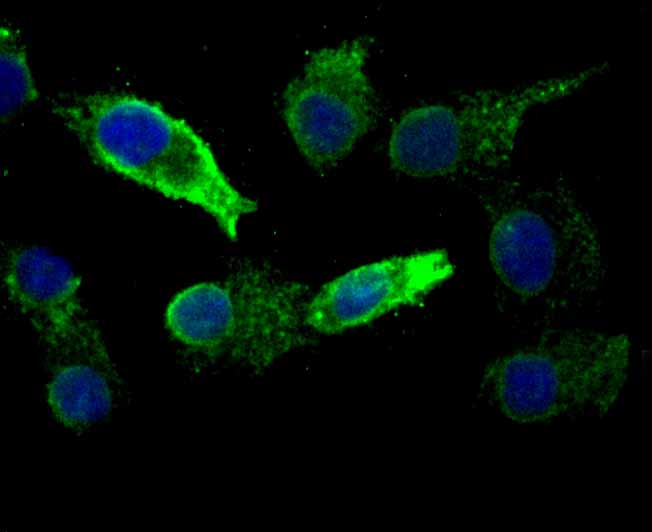 ICC staining of KDEL in A549 cells (green). Formalin fixed cells were permeabilized with 0.1% Triton X-100 in TBS for 10 minutes at room temperature and blocked with 1% Blocker BSA for 15 minutes at room temperature. Cells were probed with the primary antibody (ET7107-86, 1/500) for 1 hour at room temperature, washed with PBS. Alexa Fluor®488 Goat anti-Rabbit IgG was used as the secondary antibody at 1/1,000 dilution. The nuclear counter stain is DAPI (blue).