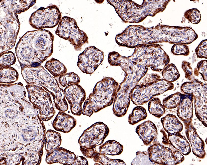 Immunohistochemical analysis of paraffin-embedded human placenta tissue using anti-KDEL antibody. The section was pre-treated using heat mediated antigen retrieval with Tris-EDTA buffer (pH 8.0-8.4) for 20 minutes.The tissues were blocked in 5% BSA for 30 minutes at room temperature, washed with ddH2O and PBS, and then probed with the primary antibody (ET7107-86, 1/100) for 30 minutes at room temperature. The detection was performed using an HRP conjugated compact polymer system. DAB was used as the chromogen. Tissues were counterstained with hematoxylin and mounted with DPX.